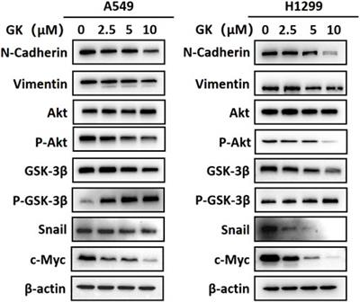 Integrating network pharmacology prediction and experimental investigation to verify ginkgetin anti-invasion and metastasis of human lung adenocarcinoma cells via the Akt/GSK-3β/Snail and Wnt/β-catenin pathway